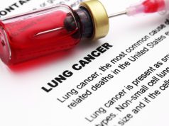 Lung Cancer Prevention