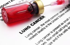 Lung Cancer Prevention