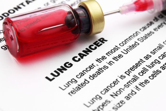 Lung Cancer Prevention