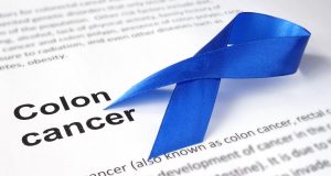 Colon Cancer Prevention