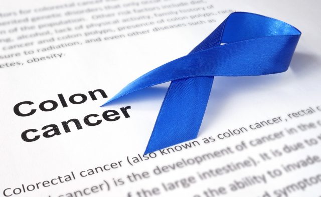 Colon Cancer Prevention