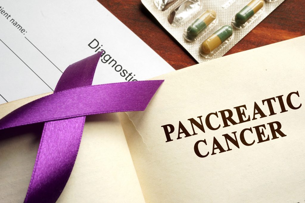 pancreatic cancer