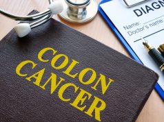 colorectal cancer