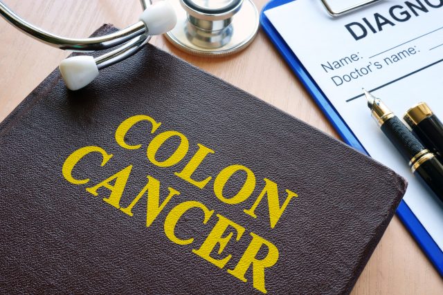 colorectal cancer