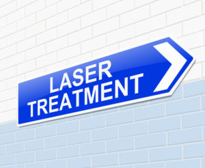 laser cancer treatment